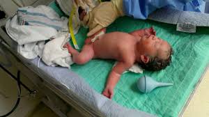 Tell me ✌ | see more about fetus, ariana grande and kendall jenner. 34 Week Outside Uterus Delivery By C Section Youtube