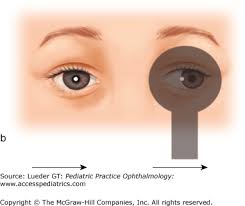 Image result for Cover Test