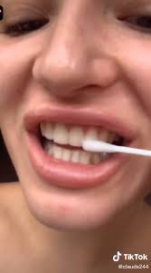 Dangerous Dentist Hacks Are Flooding Tiktok As Influencers Grind Down Teeth With Nail Files Use Bleach For Whitening