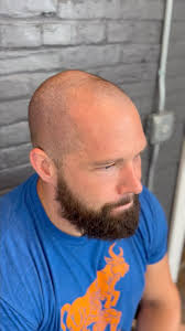 Message me for your new hairline!! 🙂, #scalpmicropigmentation #smp  #parmanentmakeup #hairline #hairtattoo #scalp #hairloss #hairlosstreatment  #lancasterpa #lancasterhairstylist #hair #tattoo ...