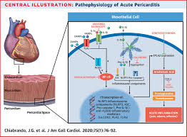 Image result for Pericarditis