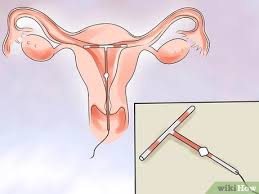 هل الواقي الذكري يمنع الحمل