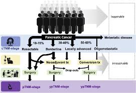 Talk to your doctor if you have any questions about the treatment plan he or she recommends. Depiction Of The Current Treatment Landscape Of Pancreatic Cancer Download Scientific Diagram