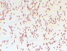 Salmonella and salmonellosis (page 1). Photo Gallery Of Pathogenic Bacterial