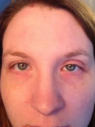 Fundraiser for Kayla Frederick by Brittany Sellers : Help Kayla's Fight  against IIH!