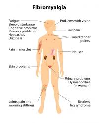 Shoulder Trigger Points Chart Www Bedowntowndaytona Com