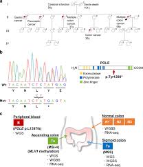 Development Of An Msi Positive Colon Tumor With Aberrant Dna