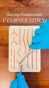 Image result for Corner Stitch