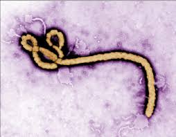 Jun 19, 2021 · guinea has declared an end to an ebola outbreak that emerged in february and killed 12 people, according to the world health organization. File Ebola Virus2 Png Wikidoc