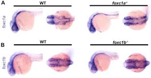 The Axenfeld-Rieger syndrome gene FOXC1 contributes to left-right  patterning