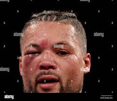 After boxing match hi-res stock photography and images