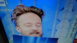 Dodi battaglia's gear and equipment including the fender stratocaster electric guitar and gibson les paul custom electric guitar. Gli Impianti Di Capelli Dei Vips La Loro Soluzione Alla Calvizie Tra Rinfoltimenti Protesi Capillari Parrucche E Parrucchini Pagina 136 Protesi Reinfoltimenti Non Chirurgici Salusmaster