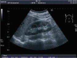 Indications for renal biopsy in patients with renal failure based on ultrasound investigations. Sonography In Renal Disease Healthcare In Europe Com