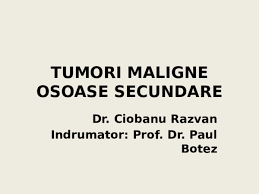 Metastaza — ce sunt metastazele canceroase mai exact? Ppt 37 Tumori Maligne Osoase Secundare Dr Ciobanu Razvan Gianina Andrei Academia Edu