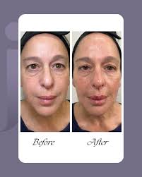 Personalized Aesthetic Care with a Compassionate Nurse Practitioner