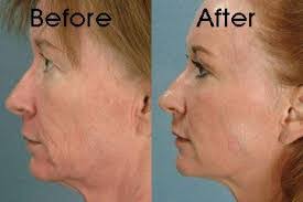 Frieda Foster's Instagram, Twitter & Facebook