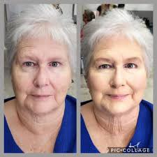 What are some effective skincare treatments for oliy skin and pimple  removal?