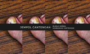 Pin Di Blanja Herbal