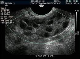 Como Engravidar Com Utero Retrovertido Moda E Consumo