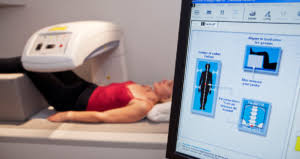 Bone Density Test Osteoporosis Screening T Score
