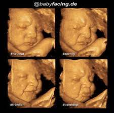 Ssw 34 gewicht 1750 gramm. Baby 3d Ultraschall Studio Babyfacing De Beitrage Facebook