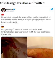 Almanya doğumlu milli boksör, ünsal arık… türkiye'yi temsil ediyor. Erdogan In Hedefindeki Boksor Unsal Arik A Bicakli Saldiri