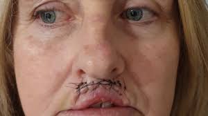 Fundraiser for Jade Walker by Jenny Monkley : Donna Timmer