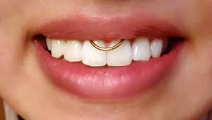 Piercing Gold Bcr Smiley A Retrouver Ici Http C Bo Fr Piercing Anneau Or Jaune Ouverture Facile Clipable Html Mouth Piercings Smiley Piercing Piercings