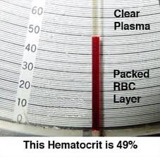 hct blood test results the important things you need to know