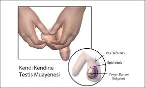 Hasil gambar untuk kriptorkismus adalah