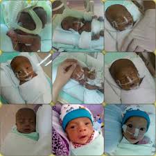 Obat batuk untuk bayi, mulai dari alami hingga resep dokter. Terlalu Aktif Ketika Hamil Anak Lahir Pramatang Dan Terpaksa Berada Dalam Wad 7 Bulan