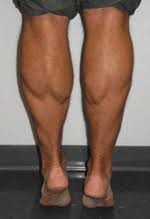 Handout achilles tendon rupture impairments and rehab.pptx. Treating The Acute Disruption Of The Achilles Tendon The Nonoperative Option