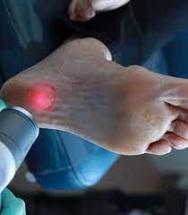 How We Treat Upper James Foot Clinic