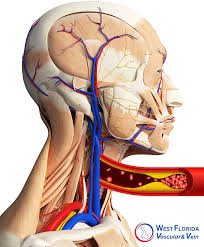 Image result for carotid artery