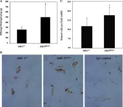 Bedford county pest control (bcpc) is a locally owned, licensed pest control and exterminator service provider located in bedford, va. Noonan Syndrome Leukemia Associated Gain Of Function Mutations In Shp 2 Phosphatase Ptpn11 Enhance Cell Migration And Angiogenesis Journal Of Biological Chemistry