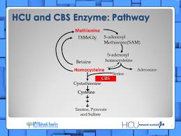 Image result for Homocystinuria