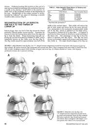 Reconstruction of lower lip is a challenging task, as it requires taking into consideration the restoration of. Reconstruction Of The Lips Hopkins Medicine Flip Ebook Pages 1 8 Anyflip Anyflip