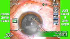 Stie cineva ceva despre dr. Clinica Dr Diaconu Operatie Cataracta Youtube
