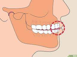How To Stop Clenching Jaw 14 Steps With Pictures Wikihow Jaw Clenching Remedies Teeth Clenching Jaw Exercises
