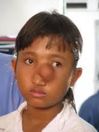 Selbstloser Einsatz in Indien