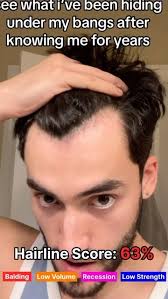Image result for HAIR Score