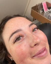 Sydney Dunning (@poisonapple_esthetics) • Instagram photos and videos