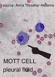 Mott Cell Medical Laboratory Science Hematology Medical Technology Labs