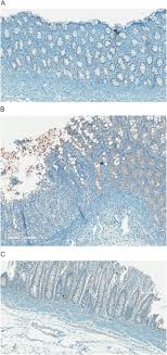 Setelah beroperasi selama 30 tahun, kini. The Development And Validation Of Methods For Evaluating The Immune System In Preweaning Piglets Sciencedirect