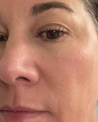 MYTH: •Oily skin doesn't need moisturizer•￼ REALITY •While oily skin  produced plenty of oil it can lack much needed water. Dehydrated skin will  produce more oil to compensate for the lack of