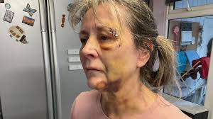 Woman 'attacked' in Mendlesham wants to move forward with life