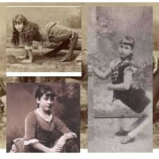 RetroTv- Personajes increíbles. Nombre: Ella Harper Apodo: The Came Girl o  La Niña Camello Condición: deformidad llamada Genu recurvatum Ella Harper  (Condado de Summer, 05 de enero de 1870 o 05 de