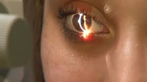 However, 20 is a good age to get lasik surgery because 95% of your body has finished developing. What Should You Know Before Getting Lasik Abc7 San Francisco