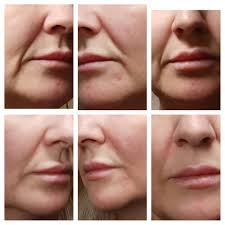 Inspirations Beauty and Aesthetics