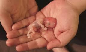 Aborto Meu Corpo Minhas Regras Mas E O Corpo Do Bebe